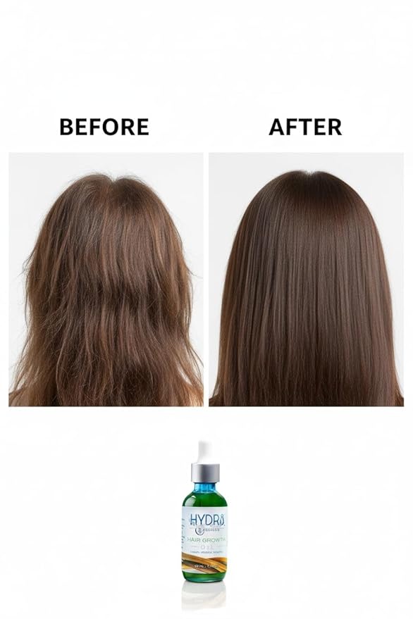 Hair Growth Oil – Natural Hair Serum for Thicker, Fuller Hair – Stimulates Hair Regrowth for Men & Women – With Castor Oil, Rosemary