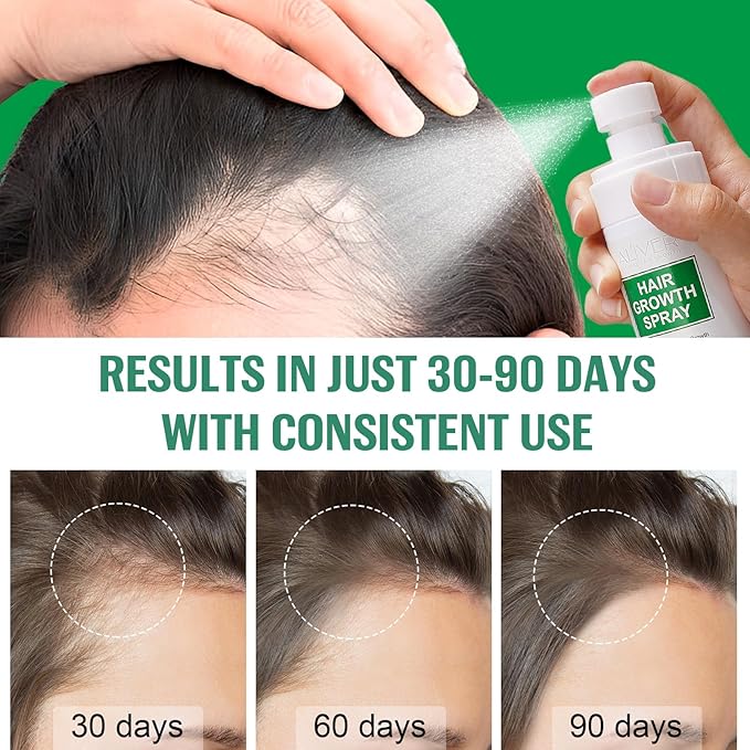 Hair Growth Spray, 2 Pack Natural Hair Growth Oil Spray With Biotin, Batana, Rosemary, and Castor Oil, Caffeine Ginseng Support Scalp Care Treatment, Thinning Hair Regrowth Thickening, Reduce damage