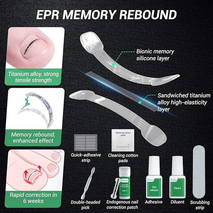 Titanium Alloy Ingrown Toenail Treatment, Nail Tools, and Ingrown Toenail Removal Kit Specially Designed for Curved Nail Repair and Ingrown Toenail Corrector (0.67/0.79in)