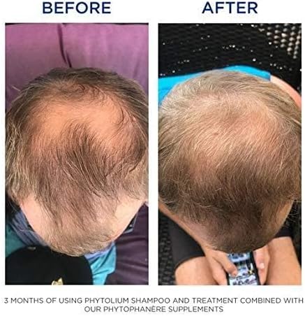 PHYTO Phytophanère 100% Natural Hair Loss Thinning Dietary Supplement, 2-Month Supply 120 Count (Pack of 1)