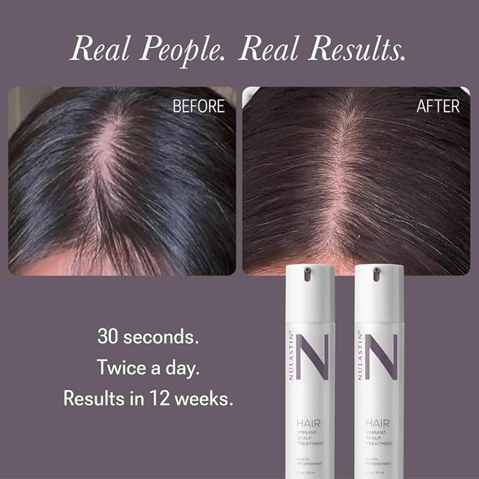 NULASTIN Scalp Serum - Vibrant Scalp Treatment to Help Improve the Look of Hair Density - Lightweight, Fast Absorbing Formula Enriched with Hair-Strengthening Ingredients (2 Count)