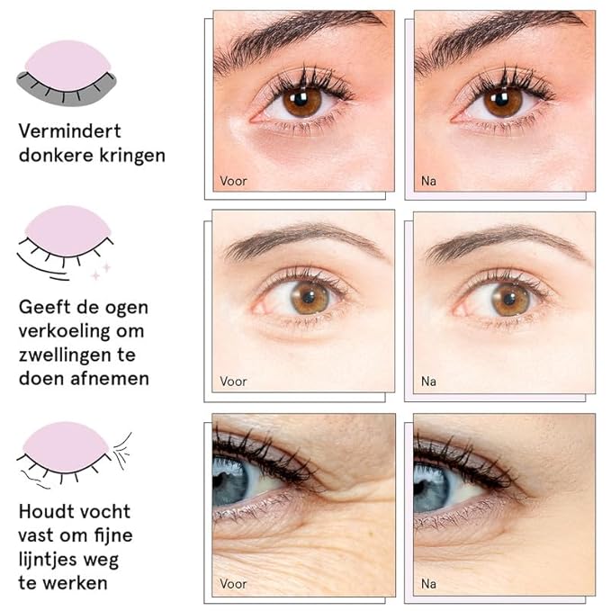 grace & stella Award Winning Under Eye Mask - Birthday Gifts For Women - Bridesmaid Gifts - Reduce Dark Circles, Puffy Eyes, Undereye Bags, Wrinkles - Under Eye Patches - Vegan (24 Pairs, Pink)