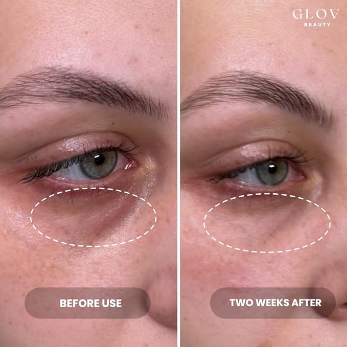 Glov Beauty - Hydrate & Brighten Eye Cream - Anti-Aging Under Eye Cream for Dark Circles, Wrinkles & Puffiness - With Retinyl Palmitate, Sodium Hyaluronate & Niacinamide - All Skin Types