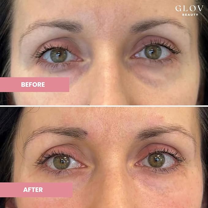 Glov Beauty - Hydrate & Brighten Eye Cream - Anti-Aging Under Eye Cream for Dark Circles, Wrinkles & Puffiness - With Retinyl Palmitate, Sodium Hyaluronate & Niacinamide - All Skin Types