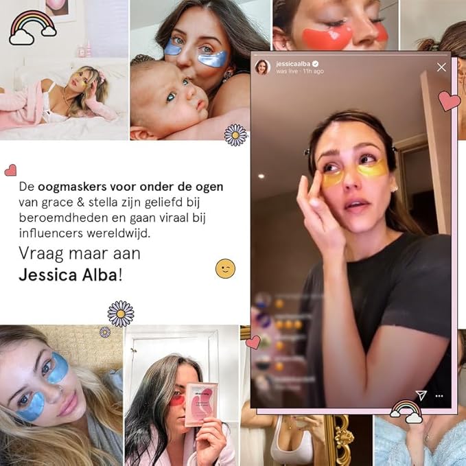 grace & stella Award Winning Under Eye Mask - Birthday Gifts For Women - Bridesmaid Gifts - Reduce Dark Circles, Puffy Eyes, Undereye Bags, Wrinkles - Under Eye Patches - Vegan (24 Pairs, Pink)