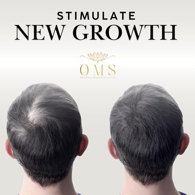 OMS Pre-Shampoo Hair Treatment Oil for Growth & Loss Prevention, Scalp Nourishing, Heat Protection, Anti-Frizz 3oz