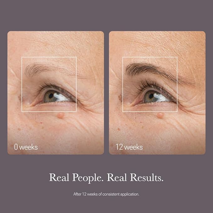 NULASTIN Shape Altering Eyebrow Serum - Brow Serum to Shape & Define - Improves the Appearance of Sparse Eyebrows for a Fuller Look - Enriched with Hair-Strengthening Ingredients (2 Count)