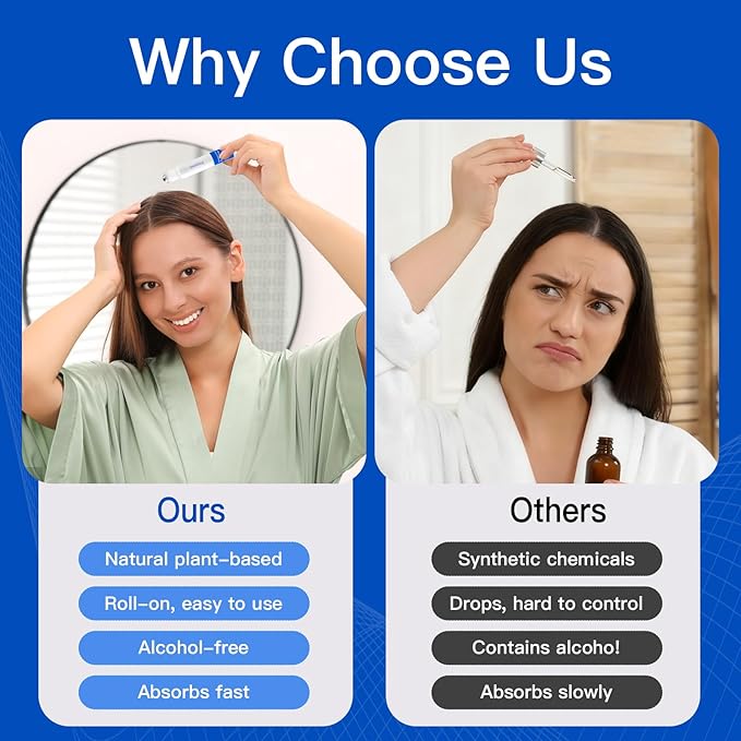 Rosemary Hair Growth Serum with Redensyl and Anagain – Roll On 25 ml, Thicker & Stronger Hair, Prevents Hair Fall & Stimulates Hair Follicles, Fights Hair Thinning & Hair Loss for All Hair Types