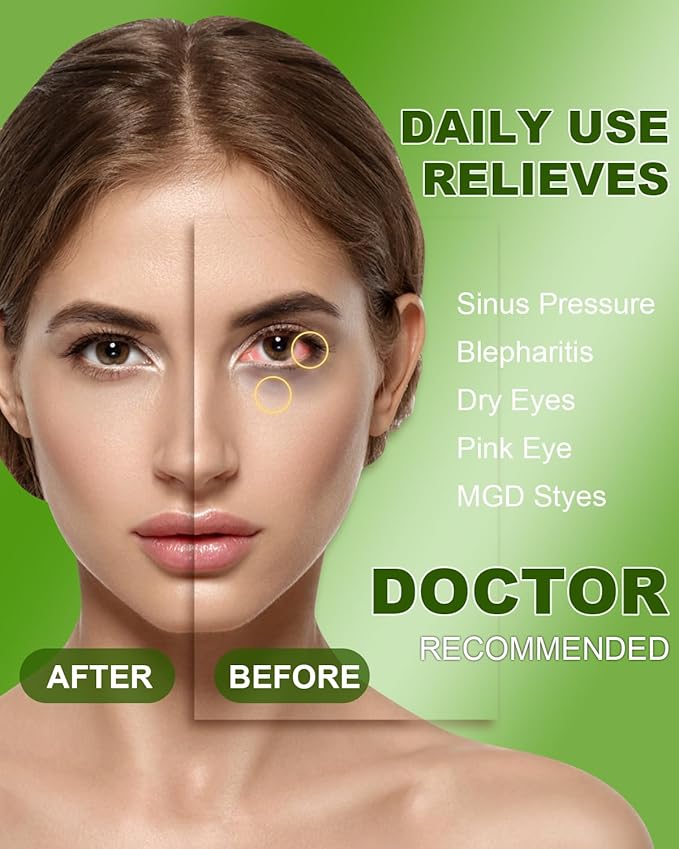 30 Packs Steam Eye Mask Chamomile,Warm Compress for Dry Eyes Sleep Mask,Hot Auto Heated Eye Masks Relaxing Gifts for Women Moist Heat Soothing Eye Fatigue,Disposable Eye Mask for SPA Essentials