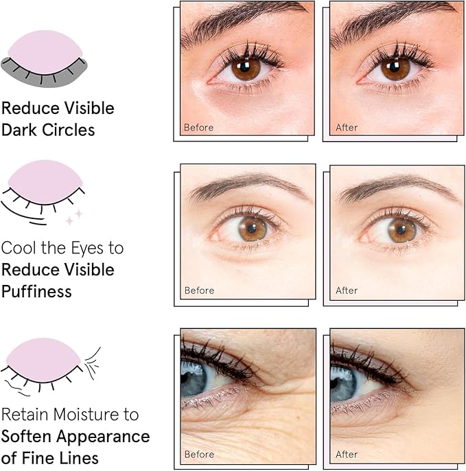 grace & stella Under Eye Patches (12 pairs) Eye Masks for Puffy Eyes and Dark Circles - Stocking Stuffers, Christmas Gifts for Women - Gifts for Birthdays, Bachelorette Party, Bridesmaids, Self Care