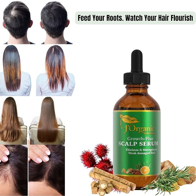 J'Organic Solutions Growth-Plus Scalp Nourishing Oil (4 Oz)