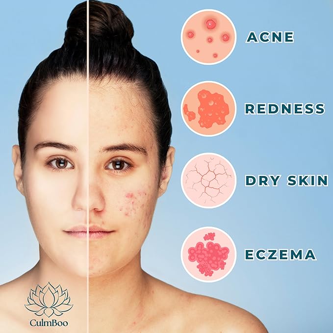 Hypochlorous Acid Spray for Face & Skin - HOCl, Acne Prone Skin, Eczema, Natural Tattoo Aftercare, Piercing Aftercare Spray, Eye Lash Cleanser, Face Mist Toner, Wound Care Cleanser, 8 Fl Oz - Aurabelle