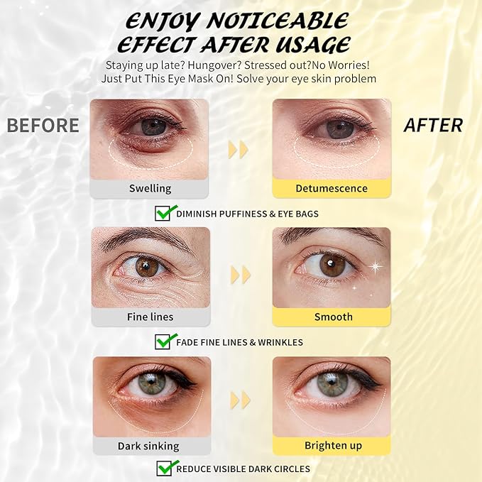 Under Eye Patches (50 Pairs), Caffeine Eye Masks for Dark Circles Puffy Eyes Undereye Bags, Collagen Eye Patches for Wrinkles and Puffiness, Skin Care Gift for Her