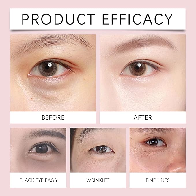 Electric Massage Eye Cream for Dark Circles, Wrinkles & Puffiness Relief, Firming, Hydrating, and Refreshing with Gentle Vibration