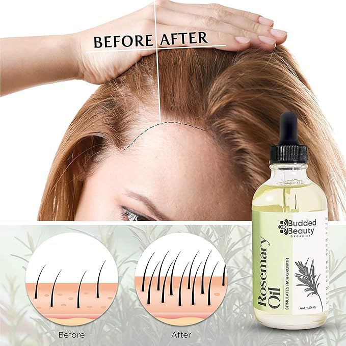 Natural Rosemary Essential Oil for Hair Growth - Hair Treatment with Dropper Bottle for Women and Men