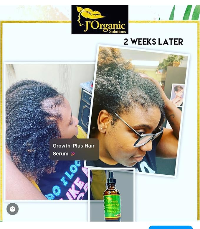 J'Organic Solutions Growth-Plus Scalp Nourishing Oil (4 Oz)