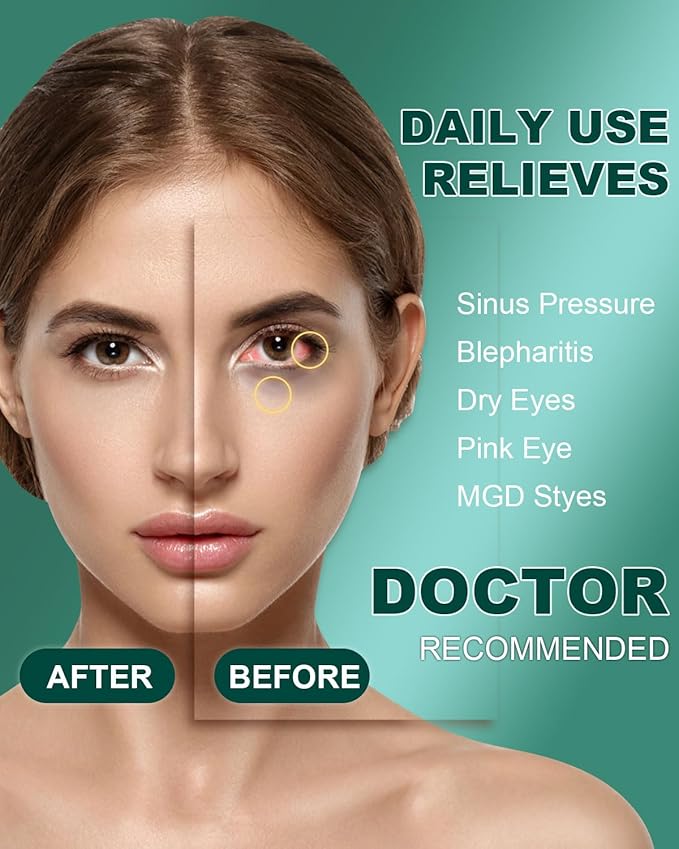 30 Packs Steam Eye Mask,Warm Compress for Dry Eyes Sleep Mask,Hot Auto Heated Eye Masks Relaxing Products for Women Moist Heat Soothing Eye Fatigue,Disposable Eye Mask for SPA Essentials