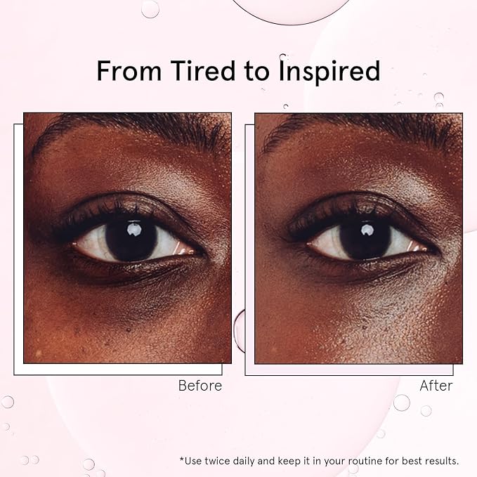 grace & stella Under Eye Brightener with Cooling Metal Rollerball - Ceramide & Caffeine Eye Cream for Puffy Eyes - Travel Size Toiletries - Vegan Skincare (15ml / 0.51floz)