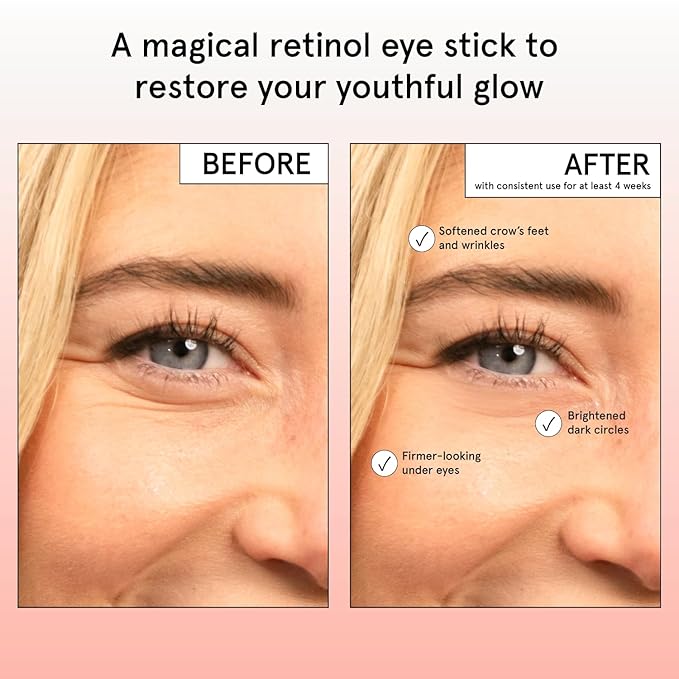 grace & stella Under Eye Brightener Balm Stick - Travel Size Toiletries - Retinol & Caffeine Eye Cream for Dark Circles, Puffiness, Wrinkles - Restore and Hydrate - Vegan Skincare (0.13oz / 3.5g)