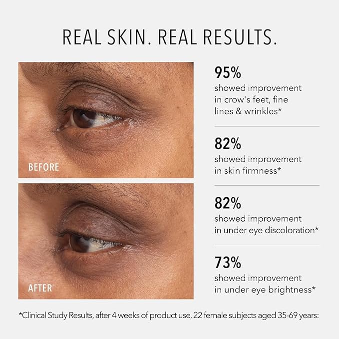 HydroPeptide Retinol Eye Renewal Lifting & Firming Eye Balm with 0.65% Universal Tri-Retinol Complex Peptide Solution, 0.5 Ounce