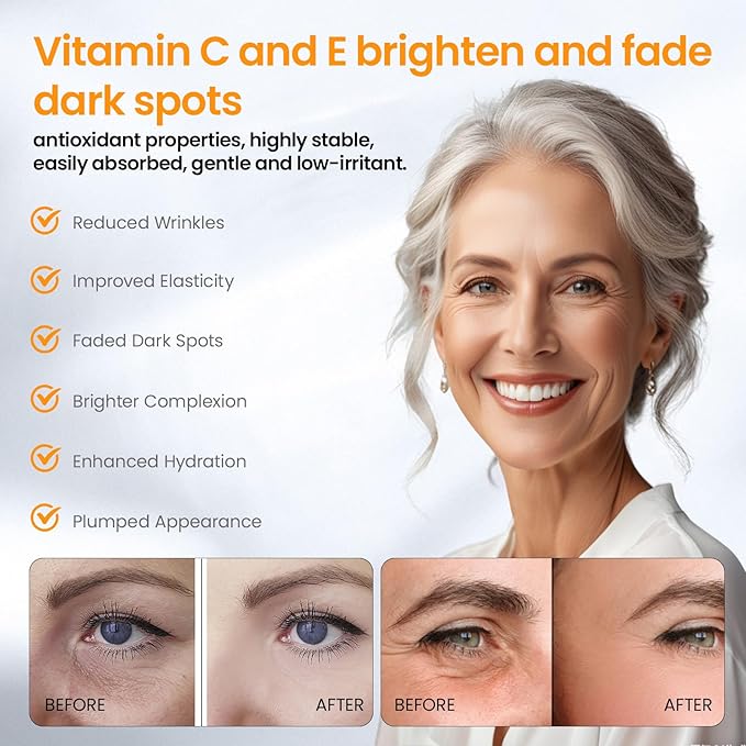Super Vitamin C Serum for Face with Pure Hyaluronic Acid,Vitamin E,Tri-Peptide,B5, – Anti Aging, Dark Spot Remover & Collagen Booster – Hydrating, for Mature Skin – 1 fl oz