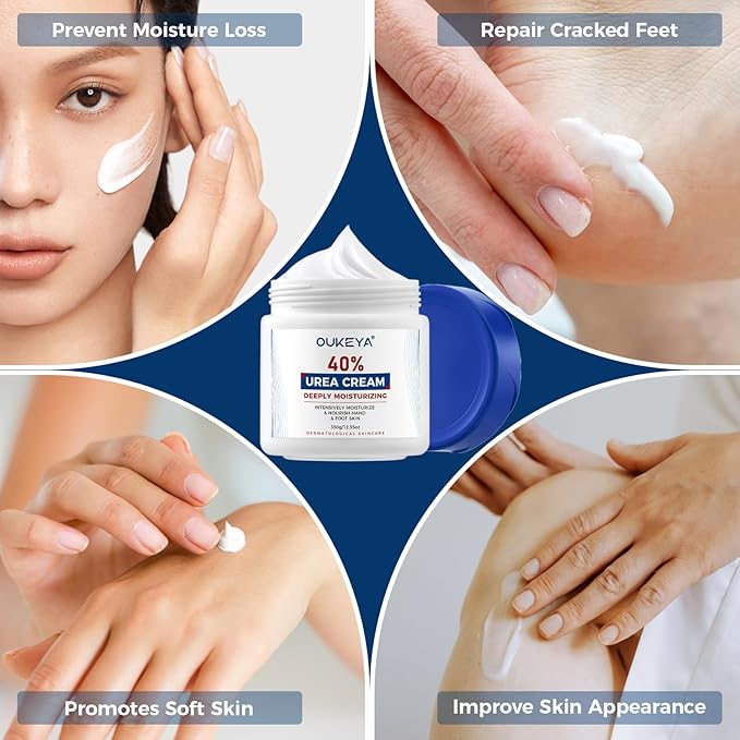 OUKEYA Urea Cream 40 Percent, Foot & Hand Cream for Dry Cracked, Urea Lotion for Feet Maximum Strength(12.35Oz)