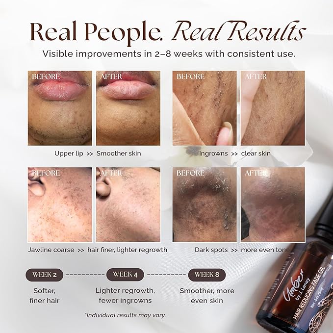 Umber by J. Lenay Hair Reducing Fade Oil – Regular Strength (Not sensitive skin), Minimizes Hair Growth for Face & Body – For Women & Men – 15ml Serum