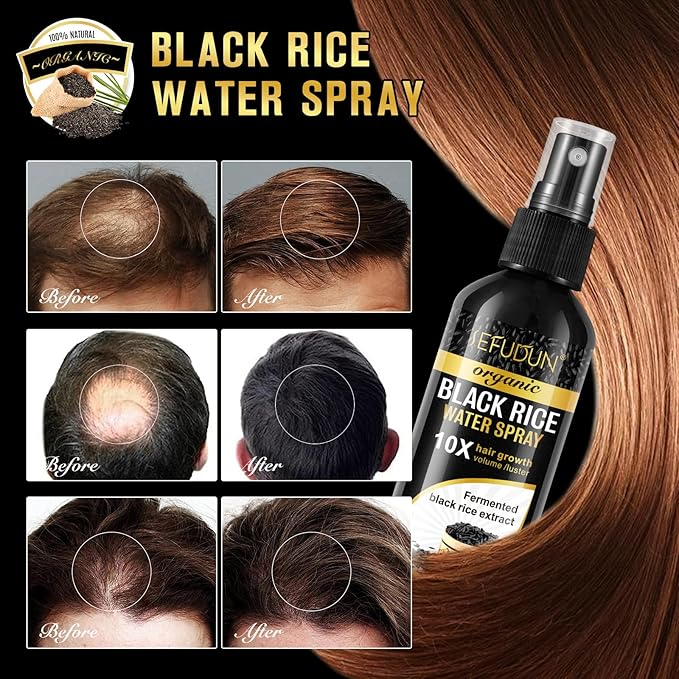 (3Pc) Organic Black Rice Water Spray for Hair Growth, A Solution with Castor Oil & Ginger Root Extract for Thicker, Fuller Hair, Targets Hair Loss and Repairs Damage 300ml/9.6 fl.oz