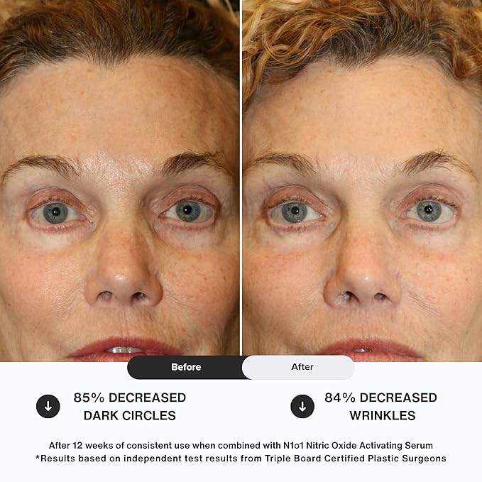 N1O1 Age-Defiance Eye Cream - Day & Night Moisturizer with Nitric Oxide, Hyaluronic Acid, Complex Peptides, Ceramides - Hydrating Eye Cream for Dark Circles, Wrinkles, Fine Lines, Puffiness - 0.5 oz.