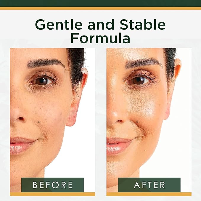 Tree of Life Beauty Vitamin C Skin Care Set, Skin Face Oil, Facial Serums for Dry and Sensitive Skin with Hyaluronic Acid & Vitamin E Soft Skin, 1 Fl Oz (Pack of 2)