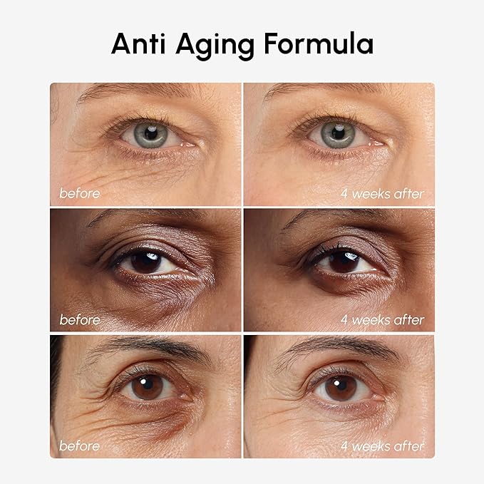 MAREE Under Eye Balm Stick with Retinol & Ceramide Complex – Facial Moisturizer for Dark Circles & Wrinkles – Under Eye Brightener Stick, Anti-Wrinkle Hydrating Face Skincare