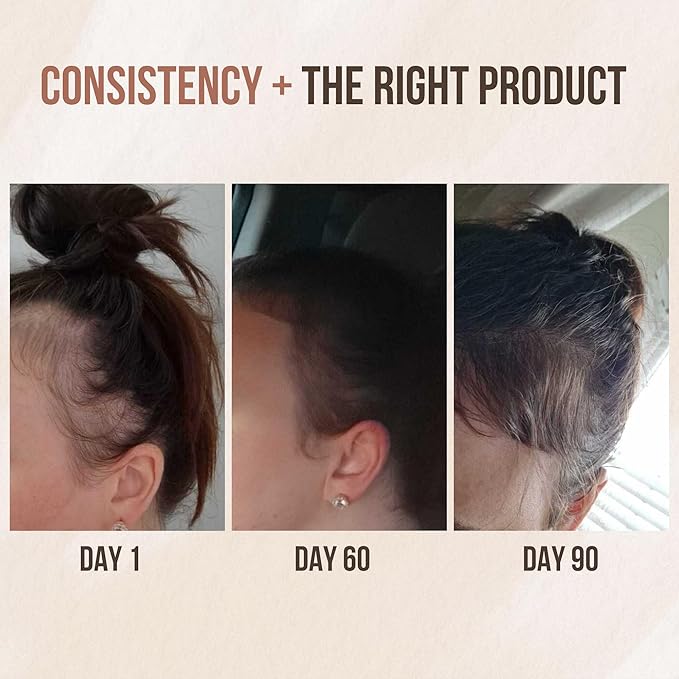 Premium Batana oil for Hair Growth |100% Raw Elaeis Oleifera for Natural Scalp Care | Dr Sebi Hair Shine treatment for Men & Women | Natural Cold Pressed Extraction Method | Liquid Formula