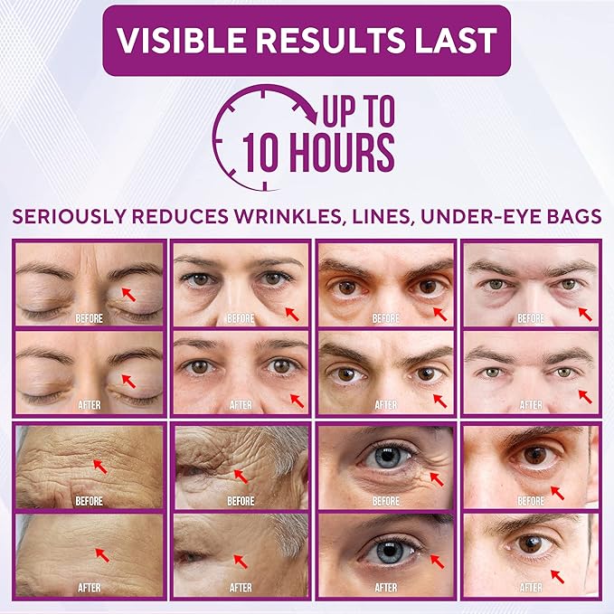 Instant Firming & Tightening Eye Cream (12 ml) – Temporarily Reduces Under-Eye Bags, Puffiness, Wrinkles & Fine Lines for a Youthful Appearance with Results Lasting 8 Hours