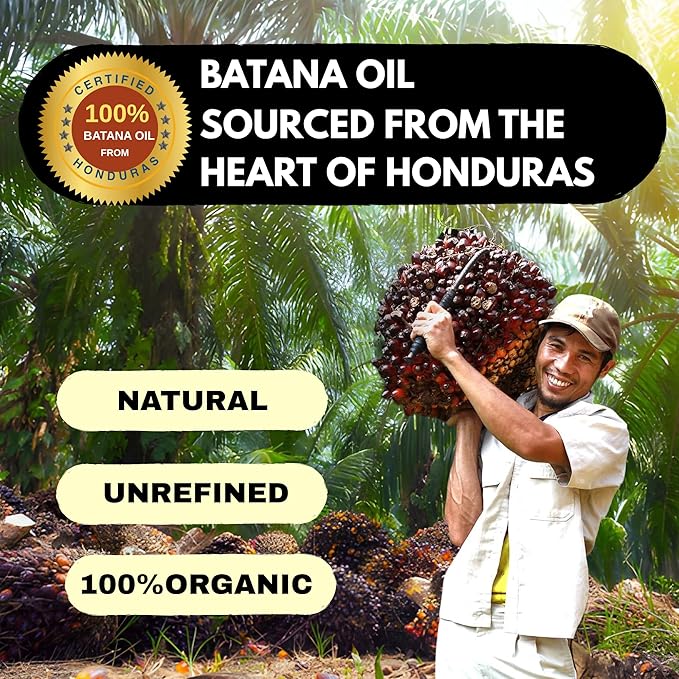 100% Raw Batana Oil – Unrefined from Honduras, Promotes Hair Growth, Thickness, and Prevents Hair Loss. Suitable for Both Men and Women. A Natural Hair Growth Oil - 4.05 fl.oz