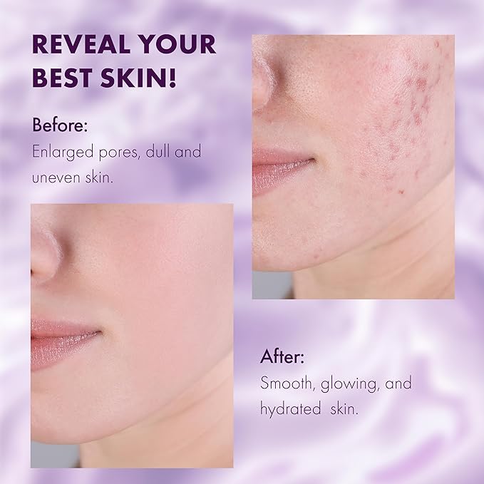 DERMAdoctor Ain't Misbehavin' Dermatologist Formulated Clarifying and Hydrating Toner with Glycolic Acid & Lactic Acid; For Oily and Acne Prone Skin, Pore Minimizer for Face and Body - 6 fl oz